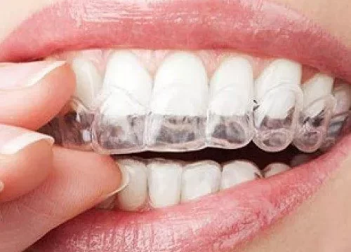 Why are Invisalign braces so effective?